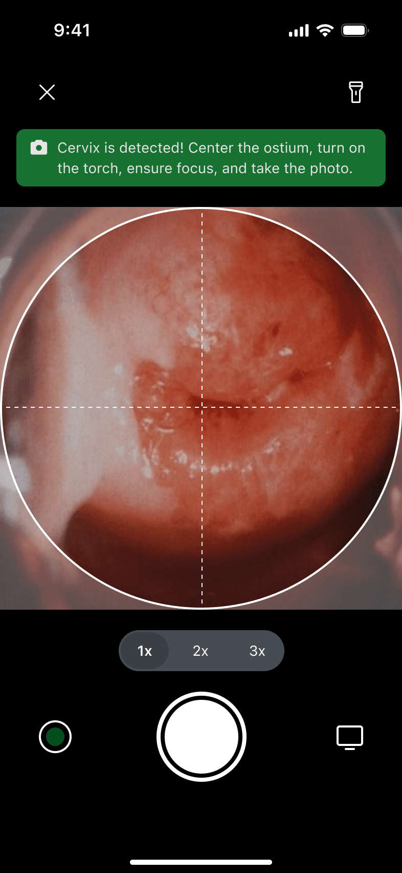 HerLens camera screen guiding the health worker to center the cervix before taking the photo