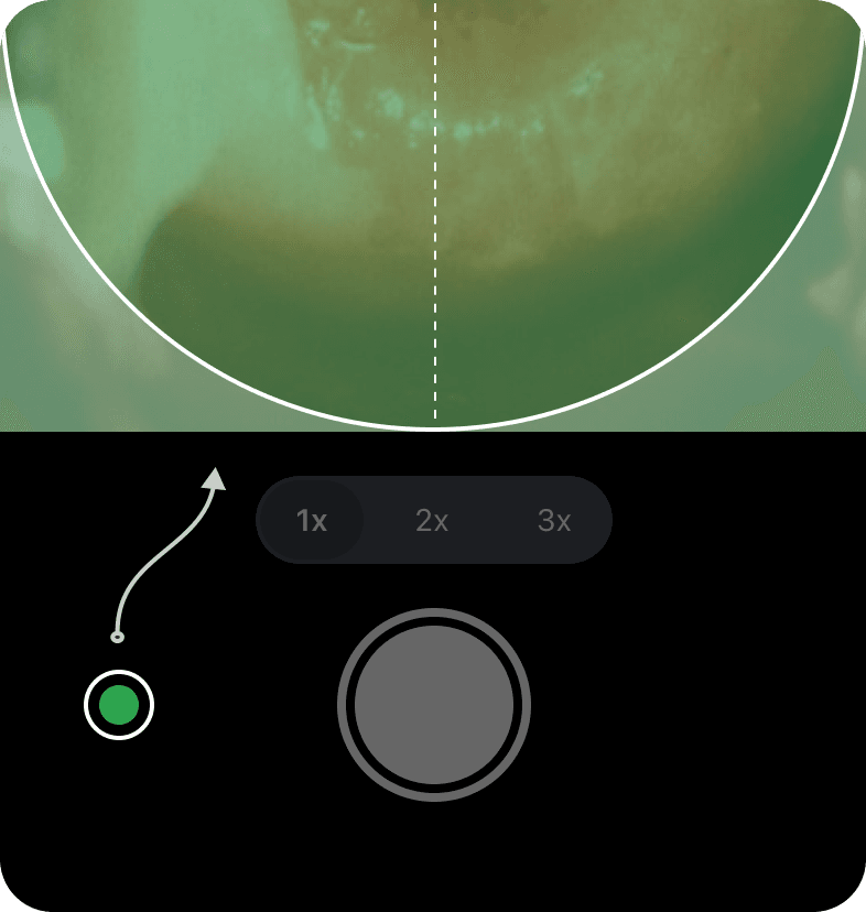 Camera view with the green filter applied to the cervix and the filter toggle highlighted