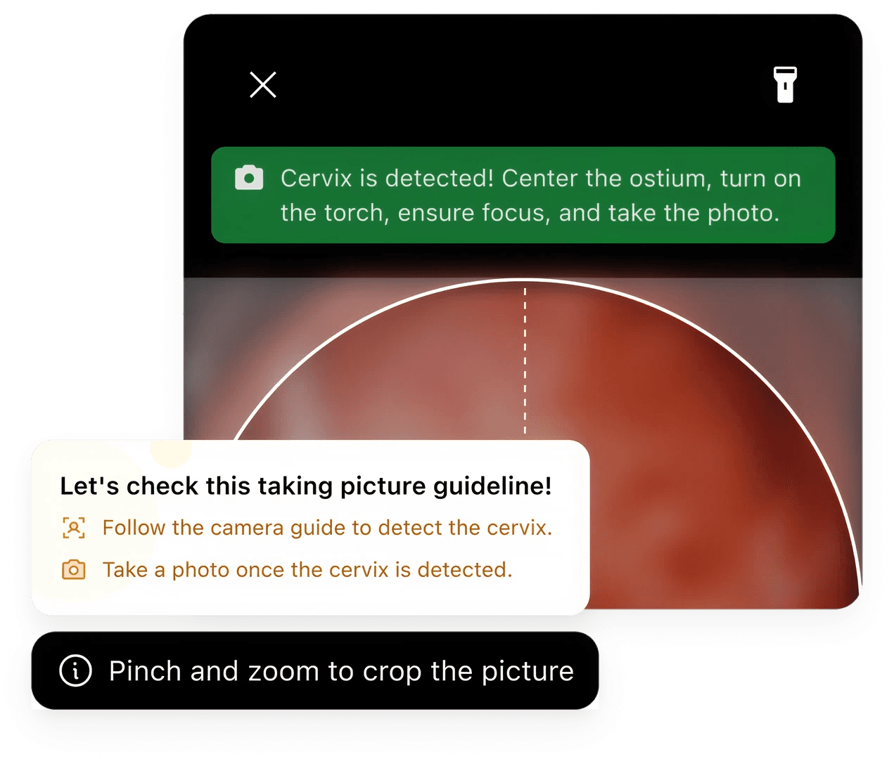 Camera screen confirming the cervix is detected, with photo-taking guidelines and a pinch-to-crop hint