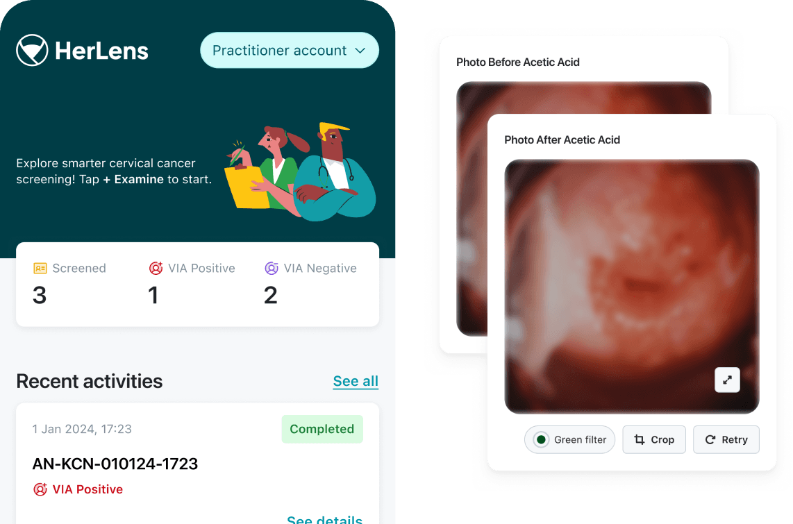 HerLens home screen with screening totals and recent examinations, beside cervical photos taken before and after acetic acid